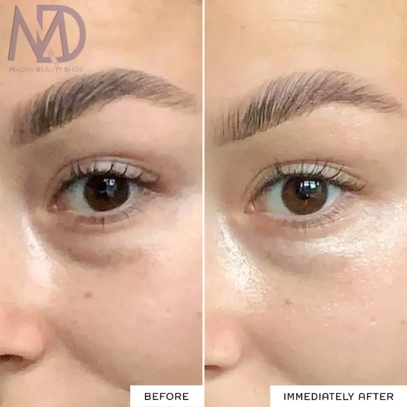تصویر کرم دور چشم REN Radiance Brightening – حجم ۵ میلیلیتر